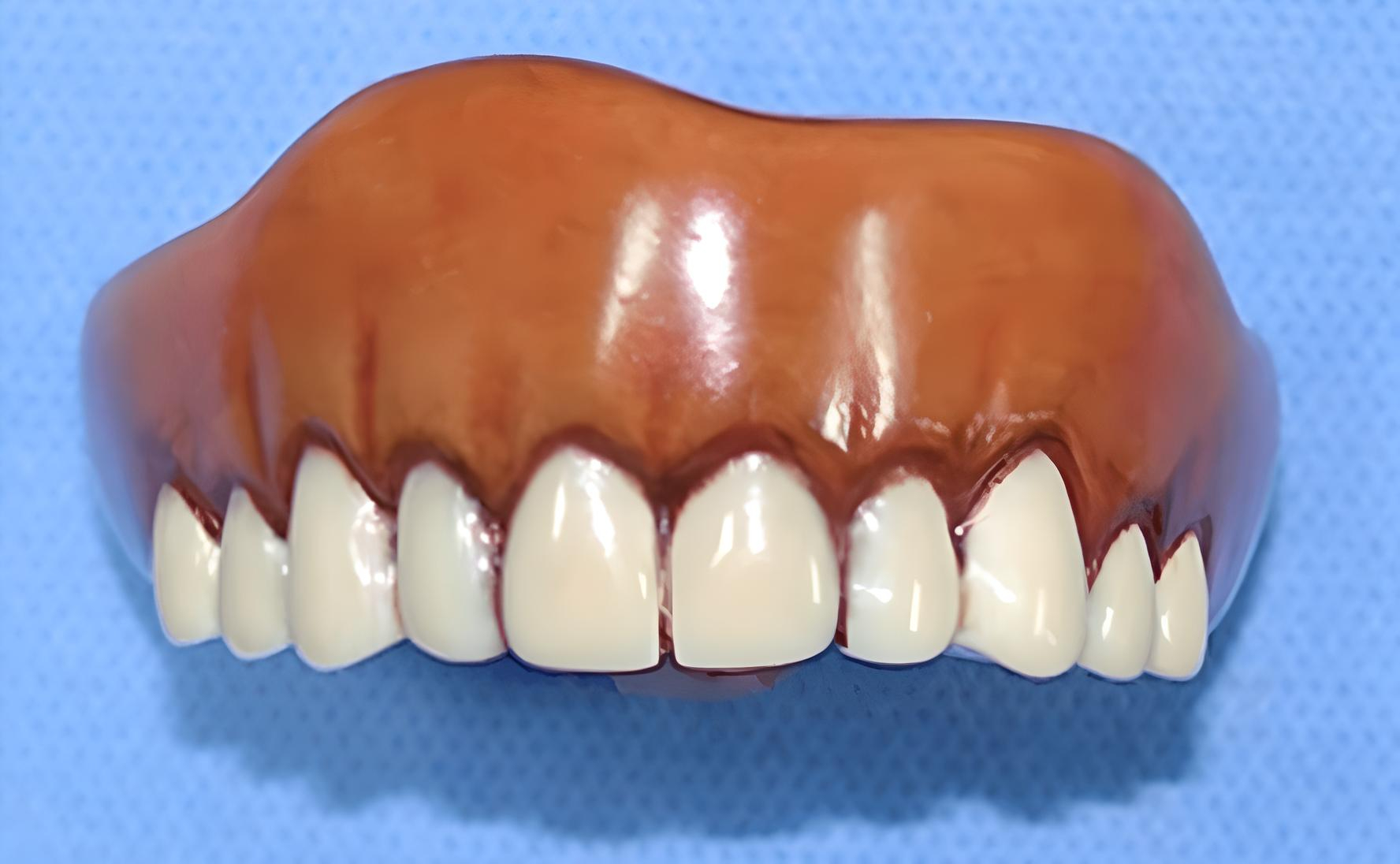A Japanese scientist has recreated a 16th century wood-plate denture out of boxwood, beeswax, red colouring and ivory. (Photo Credit: Yoshida)